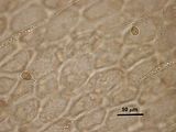 6 – Filamenti midollari con cellule secretrici